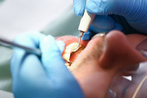 Best Emergency Care for Gum Disease in Mount Zion, GA