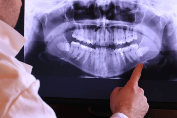 Best Emergency Treatment for Jaw Pain or Injury in Mount Zion, GA