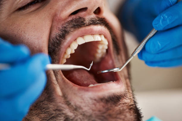 Best Broken or Chipped Tooth Repair in Mount Zion, GA